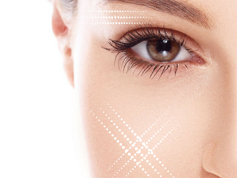 back-to-beauty-treatments-gawler-skin-tightening-solutions
